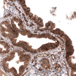 ADAM10 Antibody (CL13815) - Azide and BSA Free, Novus Biologicals 100 ul;