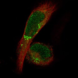 ADAM10 Antibody (CL13815) - Azide and BSA Free, Novus Biologicals 100 ul;