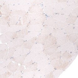 ADAM10 Antibody (CL13815) - Azide and BSA Free, Novus Biologicals 100 ul;