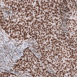 Brg1 Antibody (CL13783) - Azide and BSA Free, Novus Biologicals 100 ul;
