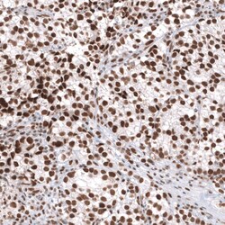 Brg1 Antibody (CL13783) - Azide and BSA Free, Novus Biologicals 100 ul;
