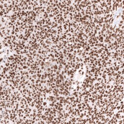 Brg1 Antibody (CL13783) - Azide and BSA Free, Novus Biologicals 100 ul;
