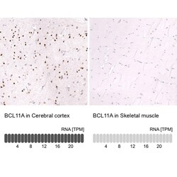 Ctip1 Antibody (CL13501) - Azide and BSA Free, Novus Biologicals 100 ul;