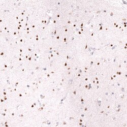 Ctip1 Antibody (CL13501) - Azide and BSA Free, Novus Biologicals 100 ul;