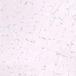 Ctip1 Antibody (CL13501) - Azide and BSA Free, Novus Biologicals 100 ul;
