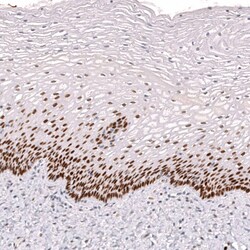 Ctip1 Antibody (CL13530) - Azide and BSA Free, Novus Biologicals 100 ul;