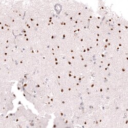 Ctip1 Antibody (CL13530) - Azide and BSA Free, Novus Biologicals 100 ul;