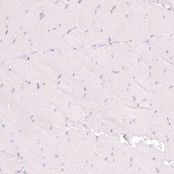 Ctip1 Antibody (CL13530) - Azide and BSA Free, Novus Biologicals 100 ul;