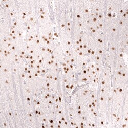 FOXO3 Antibody (CL13589) - Azide and BSA Free, Novus Biologicals 100 ul;