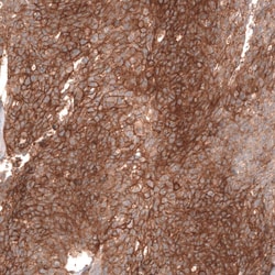 FXYD5/Dysadherin Antibody (CL14037) - Azide and BSA Free, Novus Biologicals