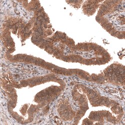 FXYD5/Dysadherin Antibody (CL14039) - Azide and BSA Free, Novus Biologicals