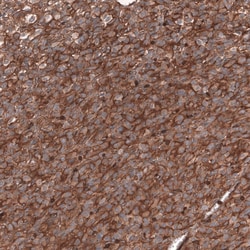 IGFBP-2 Antibody (CL13563) - Azide and BSA Free, Novus Biologicals 100