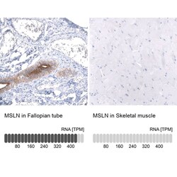 Mesothelin Antibody (CL13956) - Azide and BSA Free, Novus Biologicals 100
