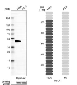 Mesothelin Antibody (CL13956) - Azide and BSA Free, Novus Biologicals 100