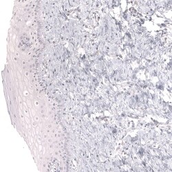 Mesothelin Antibody (CL13965) - Azide and BSA Free, Novus Biologicals 100