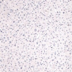 Mesothelin Antibody (CL13965) - Azide and BSA Free, Novus Biologicals 100