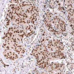 MLH3 Antibody (CL14084) - Azide and BSA Free, Novus Biologicals 100 &mu;L | Buy Online | Novus Biologicals | Fisher Scientific