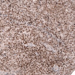 MLH3 Antibody (CL14084) - Azide and BSA Free, Novus Biologicals 100 &mu;L | Buy Online | Novus Biologicals | Fisher Scientific
