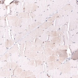 MLH3 Antibody (CL14084) - Azide and BSA Free, Novus Biologicals 100 &mu;L | Buy Online | Novus Biologicals | Fisher Scientific