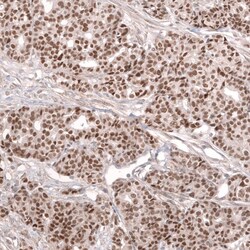 MLH3 Antibody (CL14084) - Azide and BSA Free, Novus Biologicals 100 &mu;L | Buy Online | Novus Biologicals | Fisher Scientific