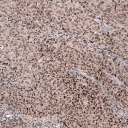 MLH3 Antibody (CL14096) - Azide and BSA Free, Novus Biologicals 100 ul;