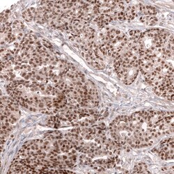 MLH3 Antibody (CL14096) - Azide and BSA Free, Novus Biologicals 100 ul;