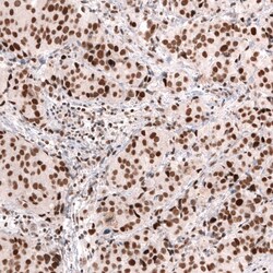MSH2 Antibody (CL13713) - Azide and BSA Free, Novus Biologicals 100 ul;
