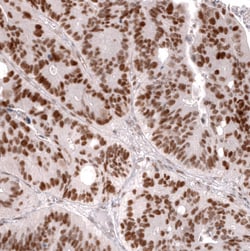 MSH2 Antibody (CL13713) - Azide and BSA Free, Novus Biologicals 100 ul;