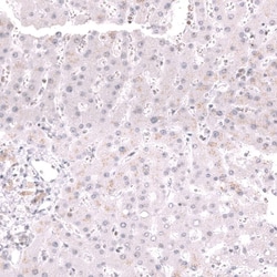 MSH2 Antibody (CL13713) - Azide and BSA Free, Novus Biologicals 100 ul;