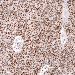MSH2 Antibody (CL13713) - Azide and BSA Free, Novus Biologicals 100 ul;