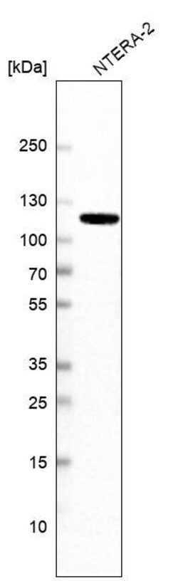 MSH2 Antibody (CL13713) - Azide and BSA Free, Novus Biologicals 100 ul;