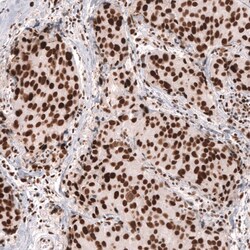 MSH2 Antibody (CL13724) - Azide and BSA Free, Novus Biologicals 100 ul;