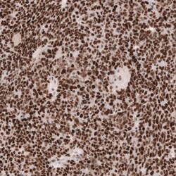 MSH2 Antibody (CL13724) - Azide and BSA Free, Novus Biologicals 100 ul;