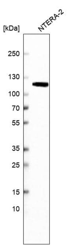 MSH2 Antibody (CL13724) - Azide and BSA Free, Novus Biologicals 100 ul;