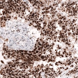 MSH2 Antibody (CL13724) - Azide and BSA Free, Novus Biologicals 100 ul;