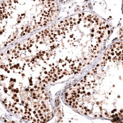 MSH2 Antibody (CL13724) - Azide and BSA Free, Novus Biologicals 100 ul;