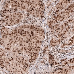 MSH6 Antibody (CL13844) - Azide and BSA Free, Novus Biologicals 100 ul;