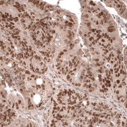 MSH6 Antibody (CL13844) - Azide and BSA Free, Novus Biologicals 100 ul;