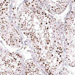 MSH6 Antibody (CL13844) - Azide and BSA Free, Novus Biologicals 100 ul;