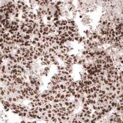 MSH6 Antibody (CL13844) - Azide and BSA Free, Novus Biologicals 100 ul;