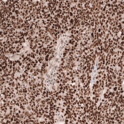 MSH6 Antibody (CL13844) - Azide and BSA Free, Novus Biologicals 100 ul;