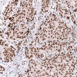 SNF5 Antibody (CL13973) - Azide and BSA Free, Novus Biologicals 100 ul;