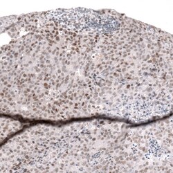 SNF5 Antibody (CL13973) - Azide and BSA Free, Novus Biologicals 100 ul;