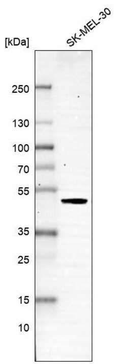SNF5 Antibody (CL13973) - Azide and BSA Free, Novus Biologicals 100 ul;