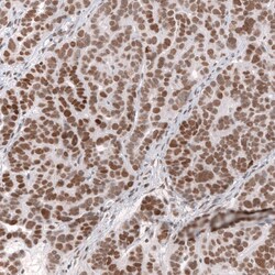 SNF5 Antibody (CL13973) - Azide and BSA Free, Novus Biologicals 100 ul;
