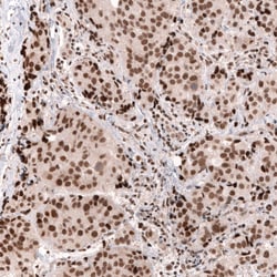 SNF5 Antibody (CL13992) - Azide and BSA Free, Novus Biologicals 100 ul;