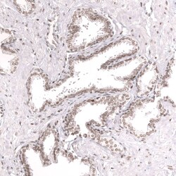 SNF5 Antibody (CL13992) - Azide and BSA Free, Novus Biologicals 100 ul;