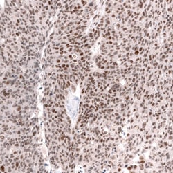 SNF5 Antibody (CL13992) - Azide and BSA Free, Novus Biologicals 100 ul;