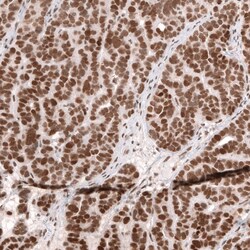 SNF5 Antibody (CL13992) - Azide and BSA Free, Novus Biologicals 100 ul;