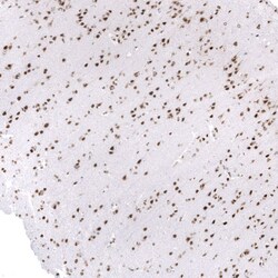 SNF5 Antibody (CL14031) - Azide and BSA Free, Novus Biologicals 100 ul;